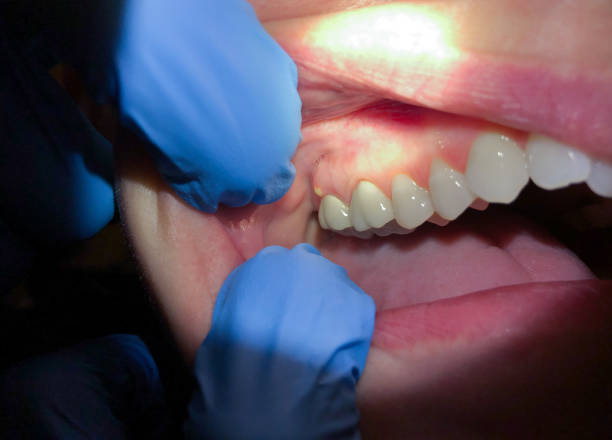 Best Urgent Dental Care for Toothaches in Blue Mountain, MS