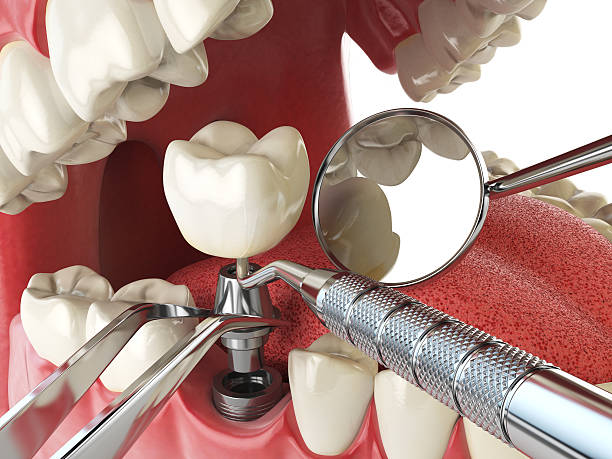 Best Emergency Dental Care for Sports Injuries in Blue Mountain, MS